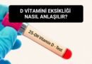 D vitamini eksikliği nasıl anlaşılır