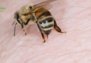 Arı Sokması: Ağrıdan Hızlı Kurtuluş ve Etkili İyileşme Yöntemleri