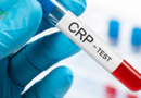 CRP (C-reaktif protein): Vücudun İşaret Fişeği