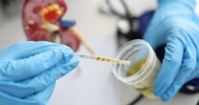 Ürik Asit Nedir? Yüksek ve Düşük Ürik Asit Seviyeleri Hakkında Bilgi