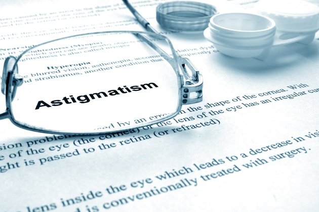 Astigmatizm: Tanımı, Nedenleri, Belirtileri ve Tedavi Yöntemleri