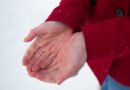 Raynaud Sendromu Hakkında Bilgi | Anadolu Sağlık Merkezi Hastanesi