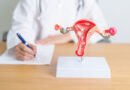 Endometriozis: Çikolata Kisti Nedir, Belirtileri ve Tedavi Yöntemleri
