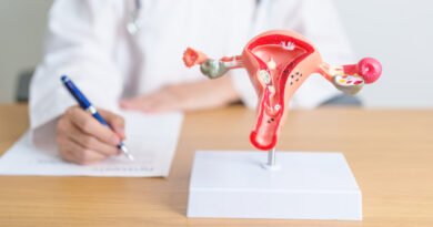 Endometriozis: Çikolata Kisti Nedir, Belirtileri ve Tedavi Yöntemleri