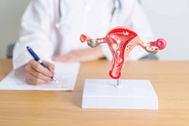 Endometriozis: Çikolata Kisti Nedir, Belirtileri ve Tedavi Yöntemleri