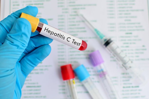 Hepatit C Aşısı | Anadolu Sağlık Merkezi Klinik Hizmetleri