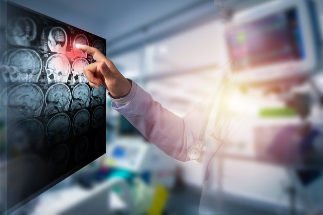 Neuro-Oncology | Anadolu Health Center