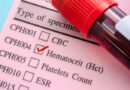 HCT (Hematokrit) Nedir? Düşüklük ve Yüksekliğin Nedenleri ile Tedavi Yöntemleri