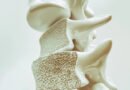 Osteoporoz (Kemik Erimesi) Nedir ve Belirtileri Nelerdir?