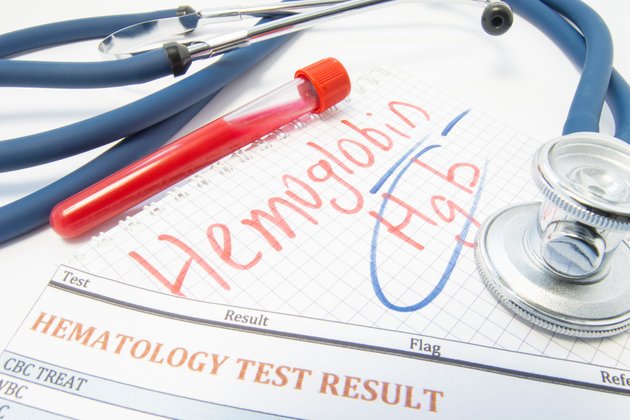 Hemoglobin (HGB): Düşüklüğü ve Yüksekliği Neyi İfade Eder?