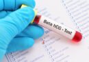 Beta HCG: Nedir ve Normal Değerleri Nasıldır?