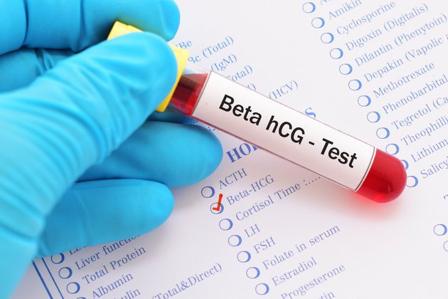 Beta HCG: Nedir ve Normal Değerleri Nasıldır?