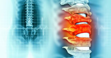 Parapleji Nedir ve Tedavi Yöntemleri Nasıl Uygulanır? | Anadolu Sağlık Merkezi Hastanesi