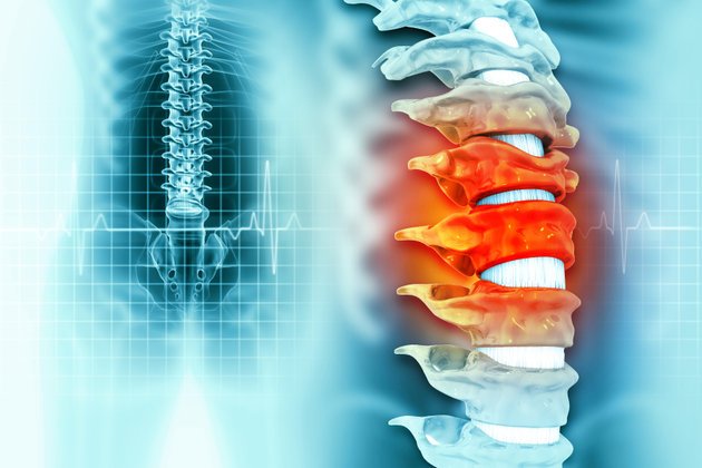 Parapleji Nedir ve Tedavi Yöntemleri Nasıl Uygulanır? | Anadolu Sağlık Merkezi Hastanesi