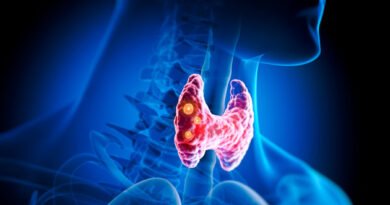 Tiroid: Tanımı, Belirtileri, Teşhis Yöntemleri ve Tedavi Seçenekleri