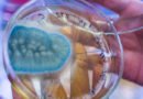 Aflatoksin Nedir ve Zararları Nelerdir?
