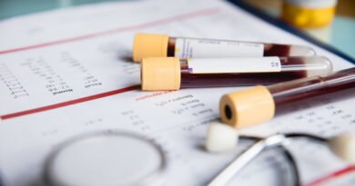 Üre Nedir? Üre Düşüklüğü ve Yüksekliği Nedenleri nelerdir?