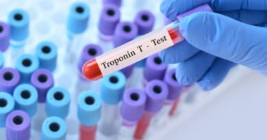 Troponin Nedir? Yüksek ve Düşük Troponin Düzeyleri Üzerine Bilgiler