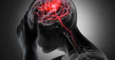 Beyin Kanaması Nedir ve Belirtileri Nelerdir?