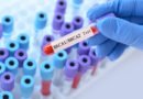 BRCA1 ve BRCA2 Genetik Testleri Hakkında Bilgi
