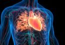 Hipertrofi Nedir? Belirtileri ve Tedavi Yöntemleri