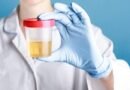 İdrarda Protein Kaçağı: Nedir, Belirtileri ve Tedavi Yöntemleri