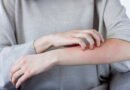 Kanser Kaşıntısı Nedir? | Anadolu Sağlık Merkezi Hastanesi
