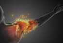 Piriformis Sendromu: Nedir, Belirtileri ve Tedavi Yöntemleri