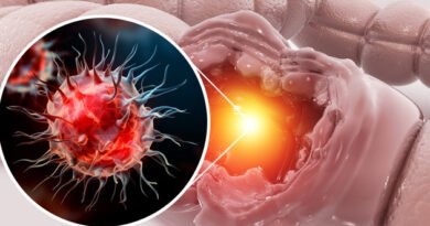 Rektum Kanseri Nedir ve Belirtileri Nelerdir?