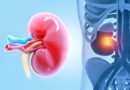 Wilms Tümörü (Nefroblastom) Nedir? Belirtileri ve Tedavi Yöntemleri