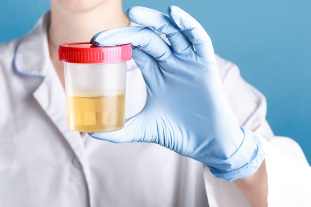 Dansite Nedir? Düşük ve Yüksek Dansitenin Anlamı Nasıldır?