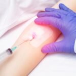 Monosit (MON) Nedir? Monositin Belirtileri, Nedenleri ve Tedavi Yöntemleri