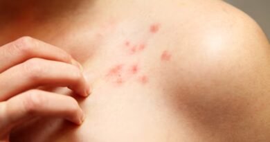 Bowen Hastalığı: Nedir? Sebepleri, Belirtileri ve Tedavi Yöntemleri