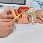 Prostat MR Füzyon Biyopsisi Nedir ve Neden Yapılır?