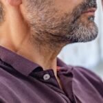 Sakal Kıran Nedir? Nedenleri, Belirtileri ve Tedavi Yöntemleri Nelerdir?