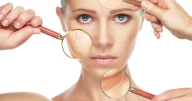 Hiperpigmentasyon Nedir? Nedenleri, Belirtileri ve Tedavi Yöntemleri