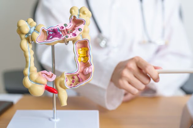 Kolonoskopi Nedir ve Nasıl Uygulanır? Hazırlık İpuçları ve Olası Riskler