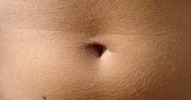 Göbek Deliği İltihabı: Nedir, Belirtileri ve Tedavi Yöntemleri