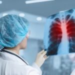 Akciğer Enfeksiyonu Nedir ve Belirtileri Nelerdir?