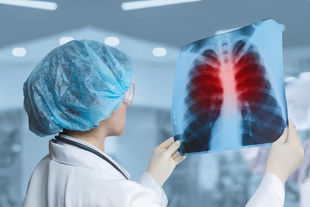 Akciğer Enfeksiyonu Nedir ve Belirtileri Nelerdir?