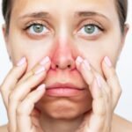 Burun Kuruluğu Nedir ve Nedenleri Nelerdir?