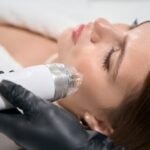 Fraksiyonel Lazer Nedir ve Uygulama Süreci Nasıl Gerçekleşir?