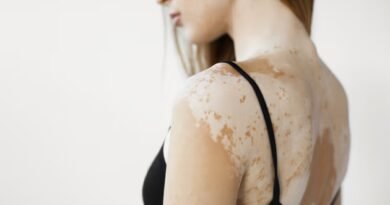 Melanin Nedir? Melanin Eksikliğinin Nedenleri Nelerdir?