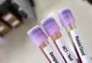 Dengue Ateşi: Nedir? Belirtileri ve Korunma Yöntemleri
