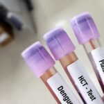 Dengue Ateşi: Nedir? Belirtileri ve Korunma Yöntemleri