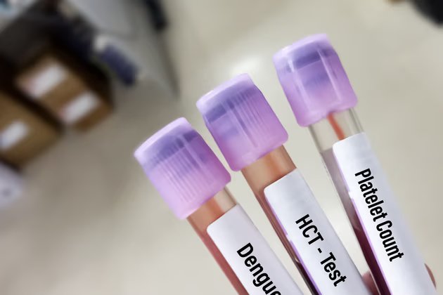 Dengue Ateşi: Nedir? Belirtileri ve Korunma Yöntemleri